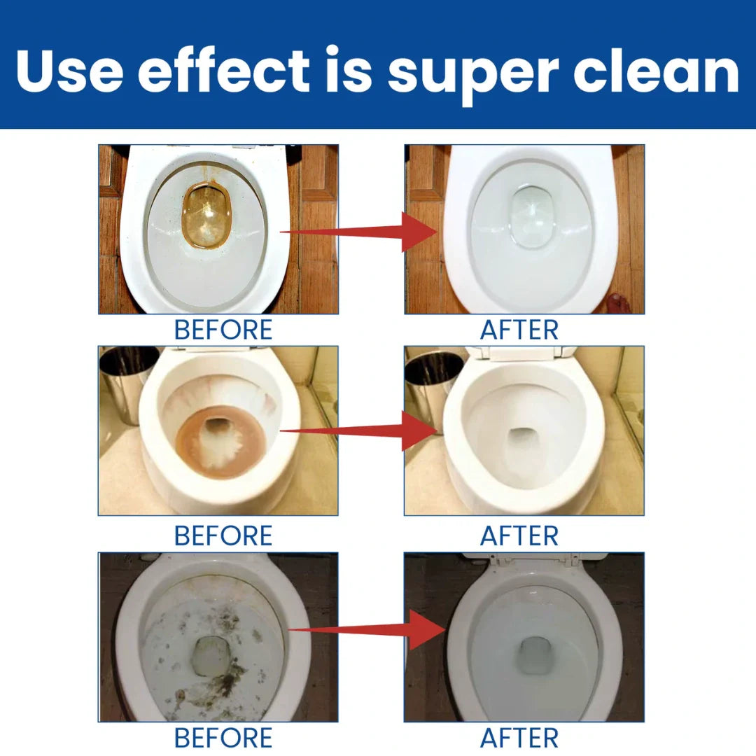 Splash™ Toilet Active Oxygen Foam Cleaning Agent (Pack Of 3)